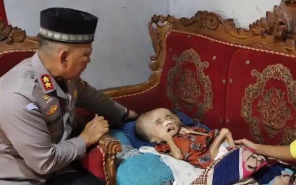 Kapolres Beltim Sambangi Bocah Penderita Hidrosefalus, Tegaskan Komitmen “Sambang Orang Sakit”
